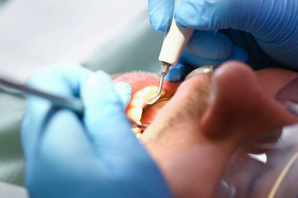 Best Urgent Tooth Repair  in Kingston, NJ