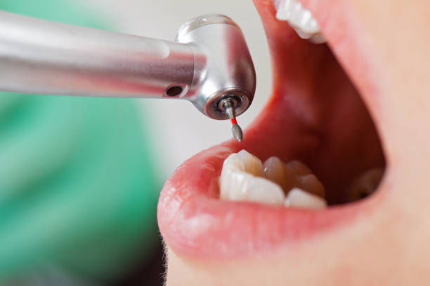 Best Cracked Tooth Emergency Dentist  in Kingston, NJ